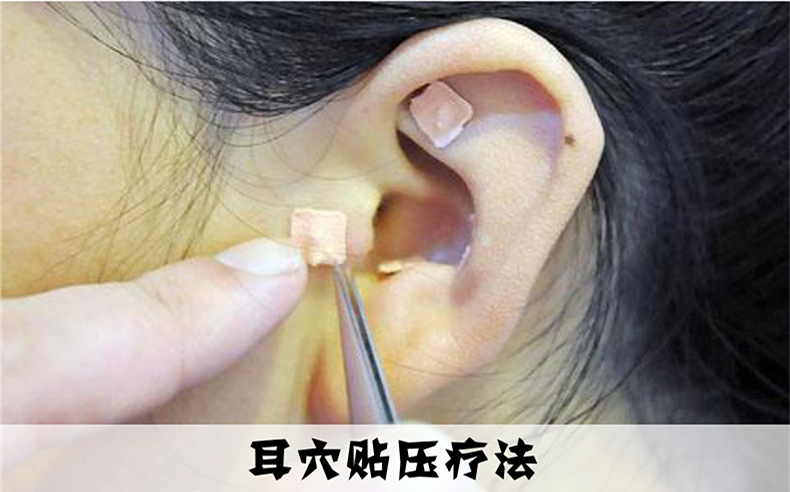 耳穴治疗皮肤病